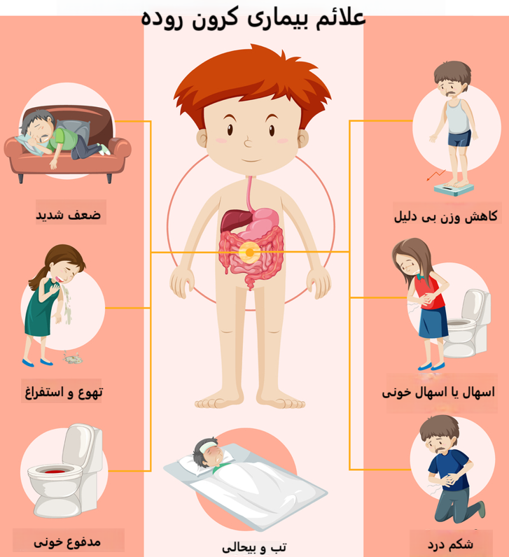 شایع ترین علائم بیماری کرون روده: علائم موضعی و سیستمیک