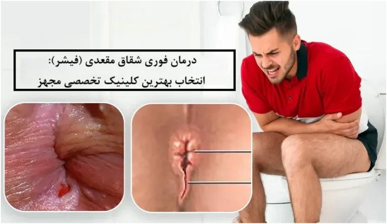 درمان فوری شقاق مقعدی (فیشر): انتخاب بهترین کلینیک تخصصی مجهز