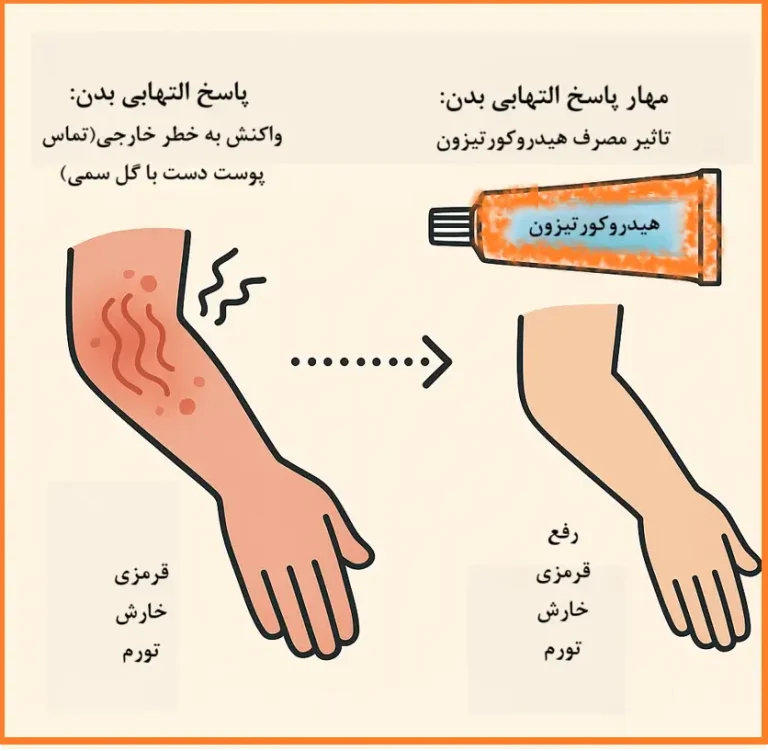 تاثیر درمانی هیدروکورتیزون: کنترل و مهار پاسخ های التهابی بدن و بیماری هموروئید مقعدی
