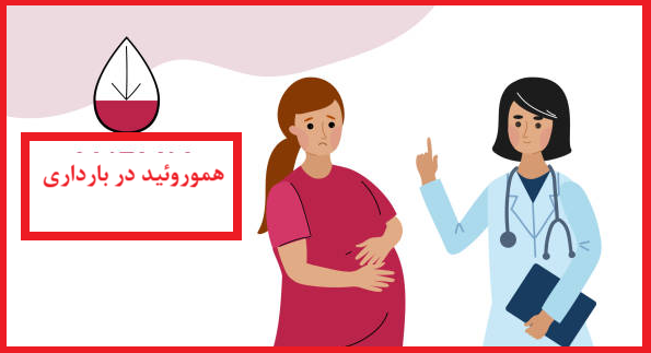 سوالات متداول در مورد هموروئید در زنان و هنگام بارداری: علل، علائم و تشخیص قطعی
