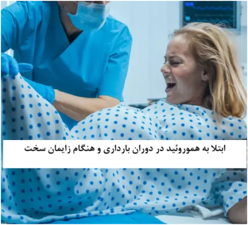 ابتلا به هموروئید در زنان؛ در دوران بارداری و هنگام زایمان