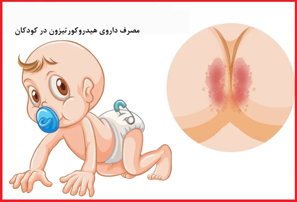 مصرف هیدروکورتیزون در کودکان: عوارض مصرف در کودکان