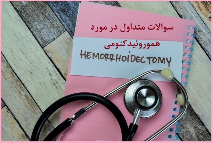 سوالات متداول در مورد هیدروکتومی بواسیر یا هموروئید