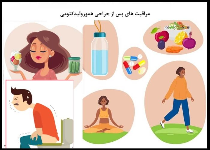 مراقبت های پس از عمل هموروئیدکتومی: