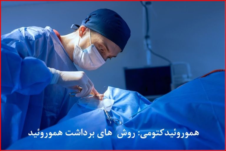 هموروئیدکتومی؛ انواع روش ها، عوارض و مراقبت های بعد از عمل
