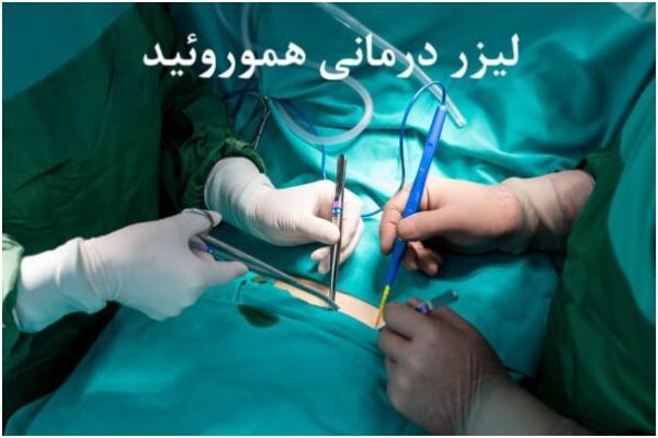 لیزر درمانی: بهترین و موثرترین روش درمان هموروئید