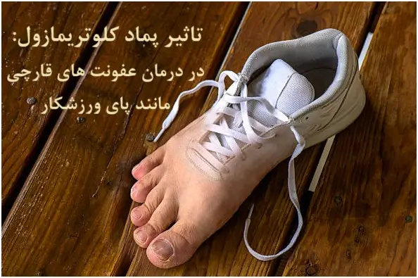 مهم ترین کاربردهای پماد کلوتریمازول: از پای ورزشکار تا واژن