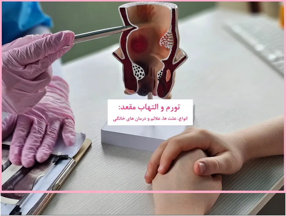 ورم مقعدی؛ انواع، علل، علائم و درمان های خانگی موثر التهاب و تورم مقعدی