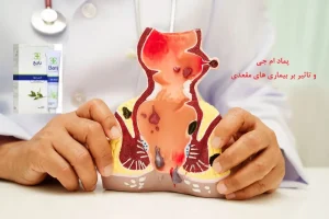پماد ام جی و تاثیر بر تسکین هموروئید
