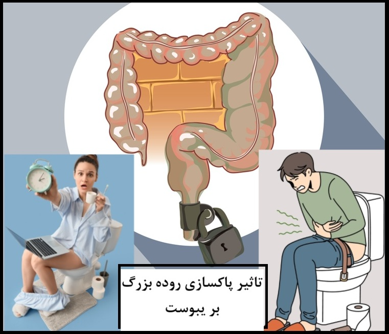 تاثیر پاکسازی روده بزرگ یا شستشوی کولون در خانه یا کلینیک و تاثیر آن بر درمان یبوست