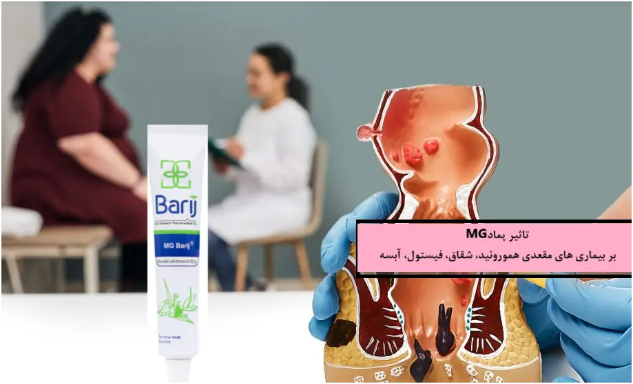 بیماری هموروئید: تاثیر پماد MG بر درمان بواسیر خفیف