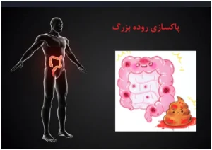 پاکسازی روده بزرگ