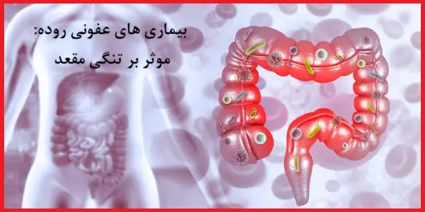 بیماری های عفونی موثر بر تنگی مقعد: از سالمونلا تا ایدز