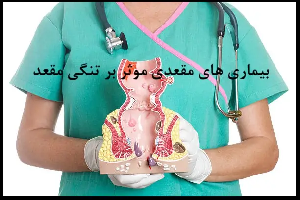 تنگی مقعد ناشی از هموروئیدکتومی: عوارض جراحی هموروئید مقعدی